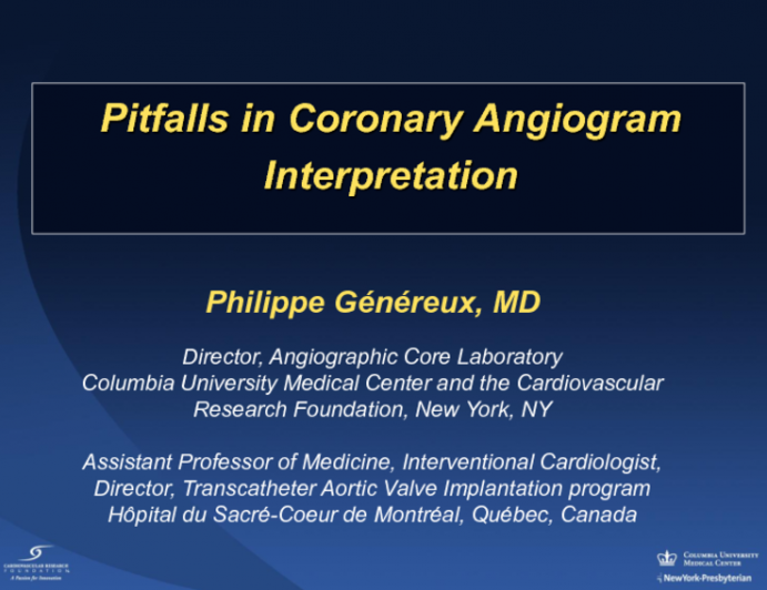 Coronary Angiography: Limitations and Artifacts