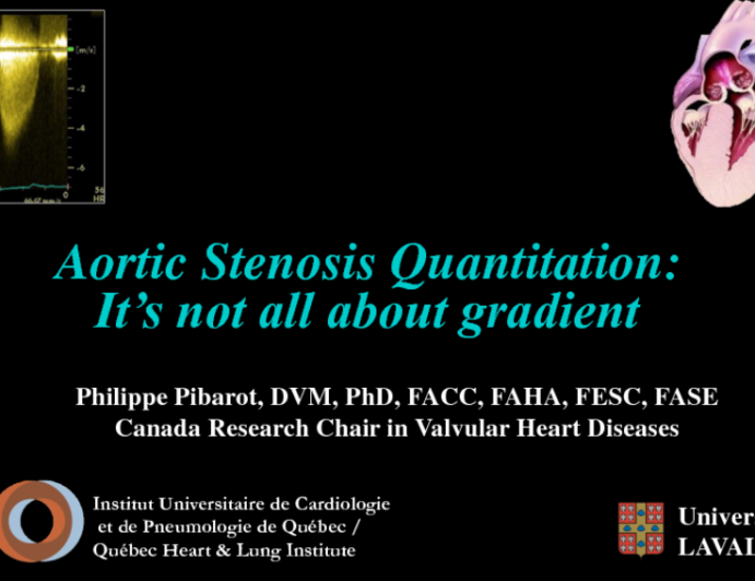 Aortic Stenosis Quantitation: It’s Not All About the Gradient