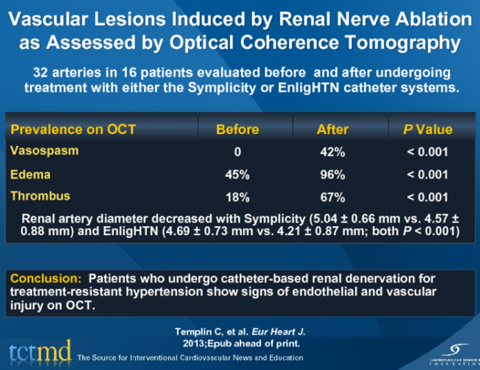 Vascular Lesions Induced by Renal Nerve Ablation as Assessed by Optical Coherence Tomography