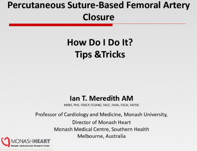 Percutaneous Suture-Based Femoral Artery Closure: How Do I Do It? Tips & Tricks