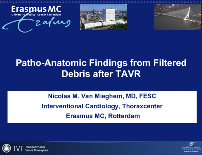 Pathoanatomic Findings from Filtered Debris After TAVR