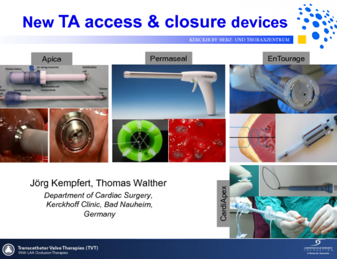 A Whirlwind Tour of the New LV Apical Access Closure Devices: Focus on Technology