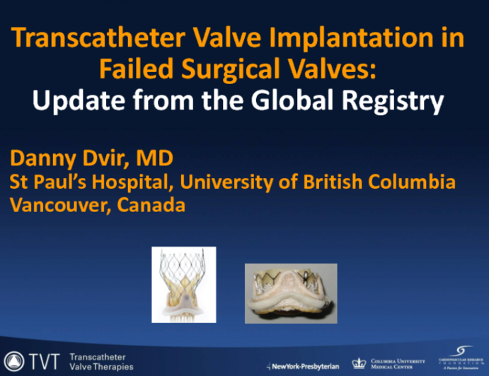 Update from the Global Valve-in-Valve TAVR Registry