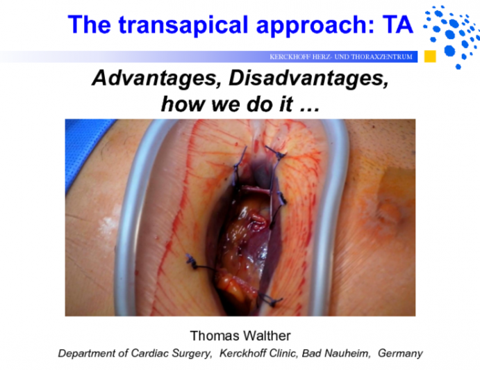 Transapical Approach: Advantages, Disadvantages, and How I Do It