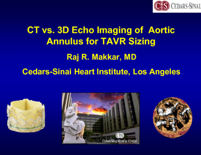 Comparison of CT and 3-D TEE for THV Sizing and Prevention of PVL