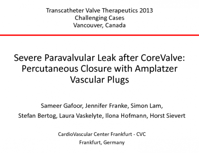 Severe Paravalvular Leak After CoreValve: Percutaneous Closure With Amplatzer Vascular Plugs