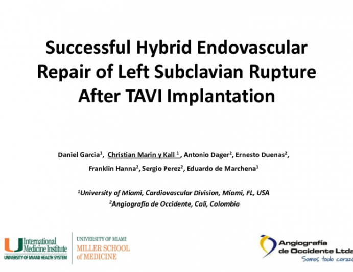 Successful Endovascular Repair of Left Subclavian Rupture After TAVI Implantation