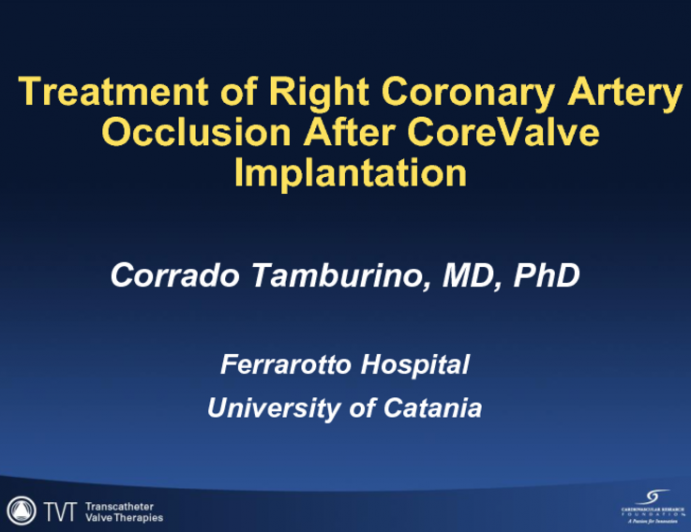 Treatment of right coronary artery occlusion after CoreValve implantation