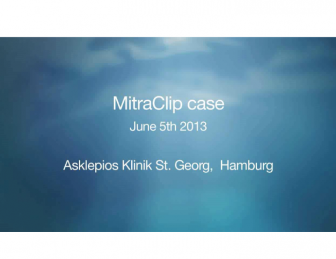 Taped Case 2: MitraClip in Degenerative MR