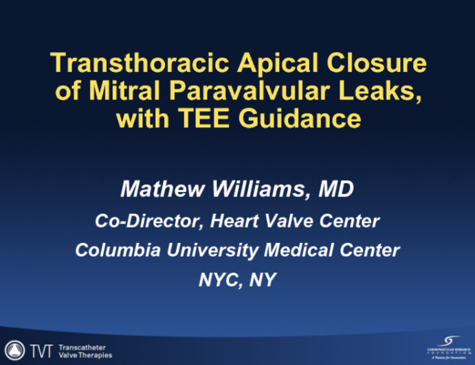 Transthoracic Apical Closure of Mitral Paravalvular Leaks, with TEE guidance (Including Case Presentations)