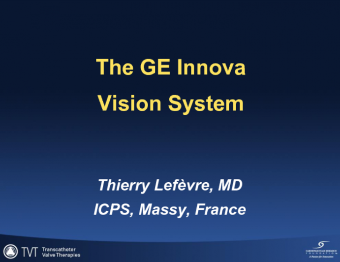 The GE Innova Vision System