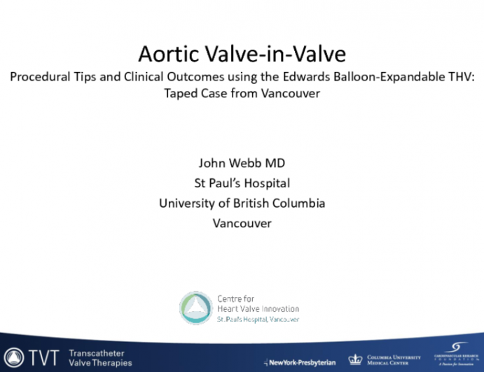 Procedural Tips and Clinical Outcomes using the Balloon-Expandable THV (Edwards): Taped Case from Vancouver
