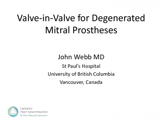 Description and Results of Valve-in-Valve for Degenerated Mitral Protheses