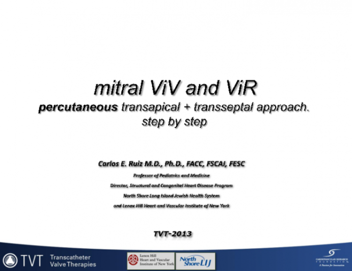 Mitral Valve-in-Valve (or Rings): How I Do the Transseptal, Transapical Approach (Case Examples)
