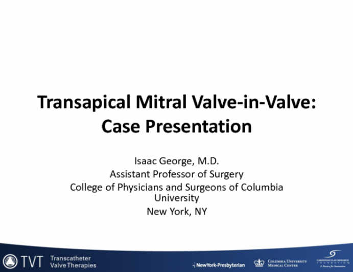 Mitral Valve-in-Valve (or Rings): How I Do the Transapical Approach