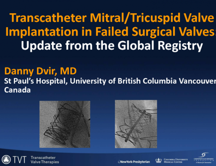 Mitral and Tricuspid Valve-in-Rings from the Global Registry