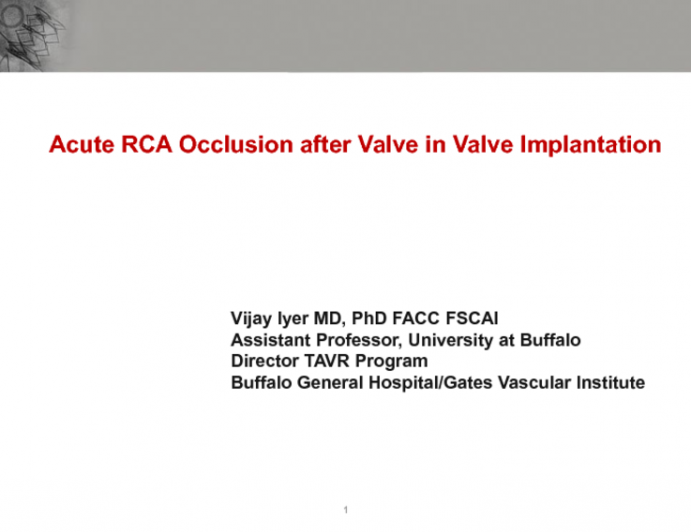 Acute RCA occlusion secondary to valve in valve deployment