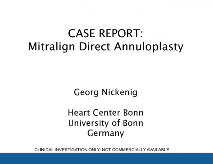 Case Report from Bonn Germany with the Mitralign Annuloplasty System