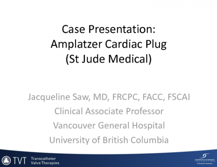 Case Presentation: Amplatzer Cardiac Plug (St. Jude Medical)