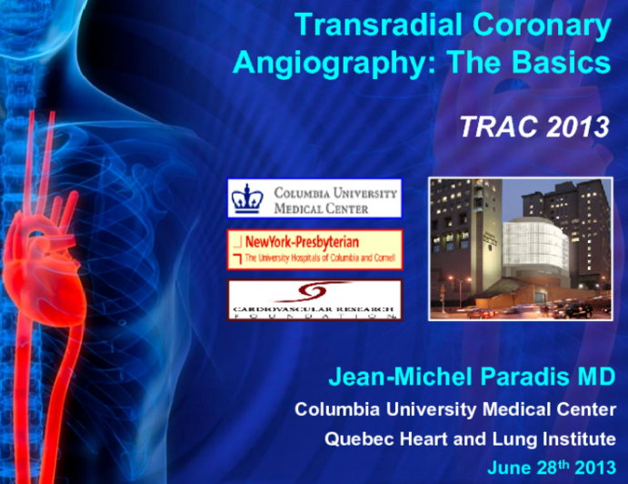 Transradial Coronary Angiography: The Basics