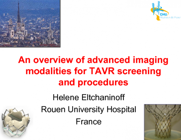 An Overview of Advanced Imaging Modalities for TAVR Screening and Procedures