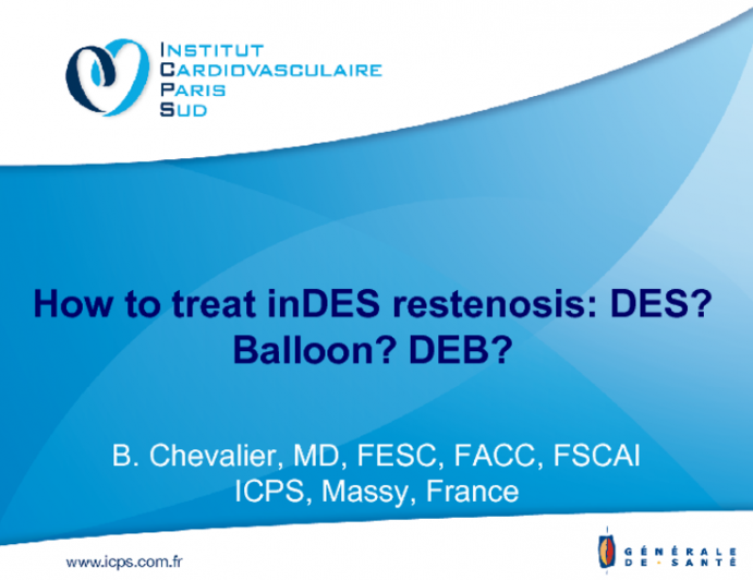 How to Treat InDES Restenosis: DES? Balloon? DEB?