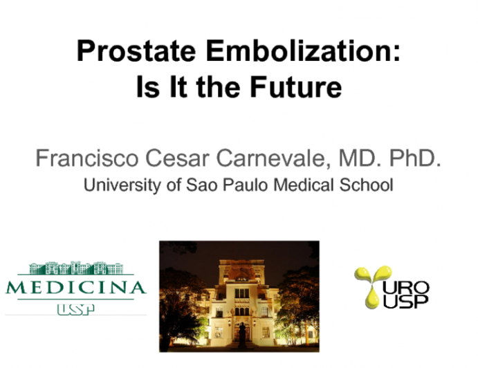 Prostate Embolization: Is It the Future?