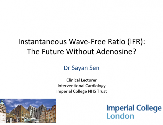 Instantaneous Wave-Free Ratio (iFR): The Future Without Adenosine?