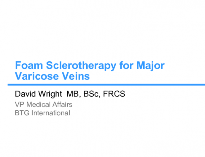 Foam Sclerotherapy for Major Varicose Veins