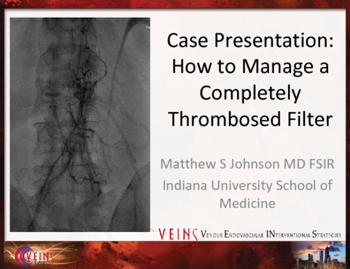 Case Presentation: How to Manage a Completely Thrombosed Filter