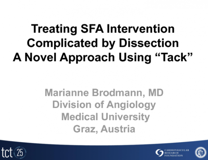 Treating SFA Intervention Complicated by Dissection: A Novel Approach Using "Tack"