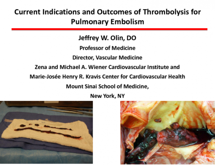 Current Indications and Outcomes of Thrombolysis for Pulmonary Embolism