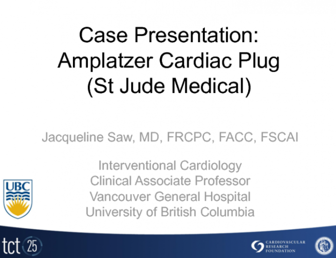 Amplatzer Cardiac Plug (ACP)