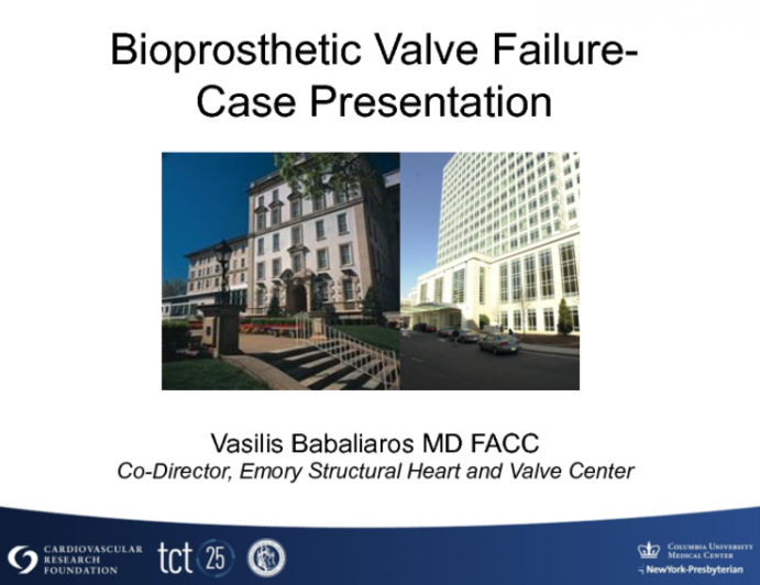 Bioprosthetic Valve Failure - Case presentation