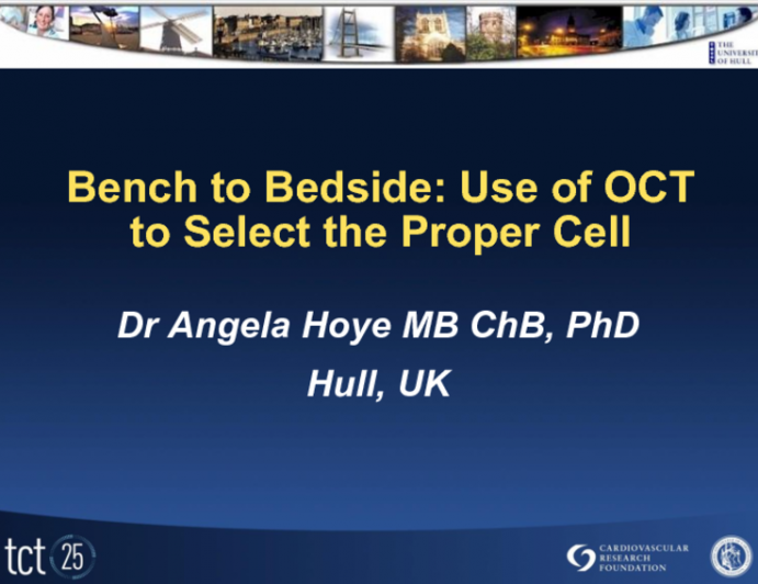 Bench to Bedside: Use of OCT to Select the Proper Cell