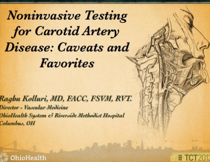 Noninvasive Testing for Carotid Artery Disease: Caveats and Favorites