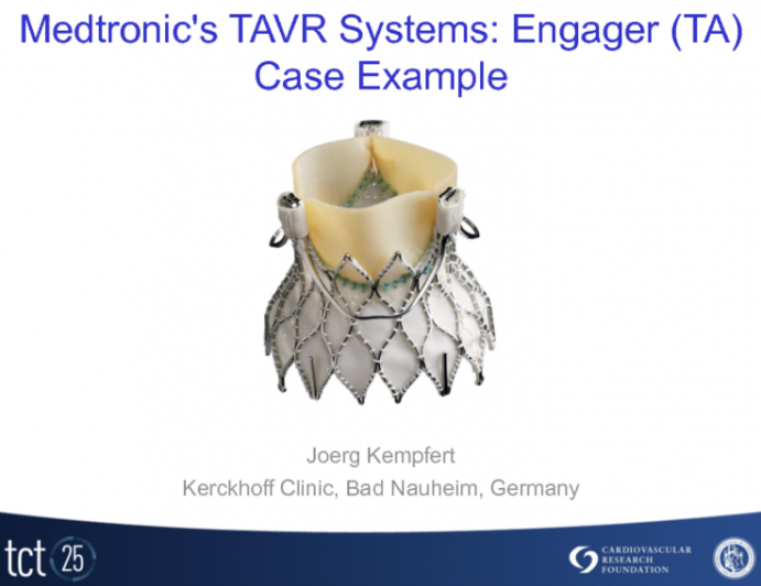 Case Examples(2)