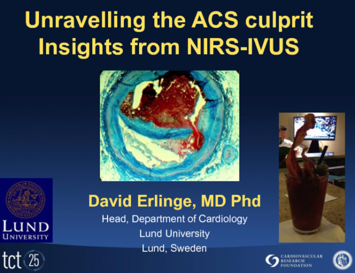 Unraveling the ACS Culprit: Insights from NIRS-IVUS