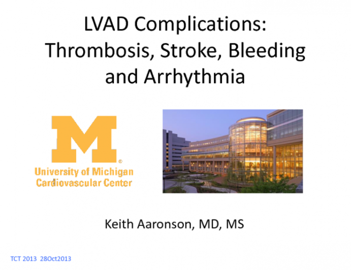 LVAD Complications State-of-the-Art: Current Status on Thrombosis, Stokes, Bleeding and Arrhythmias