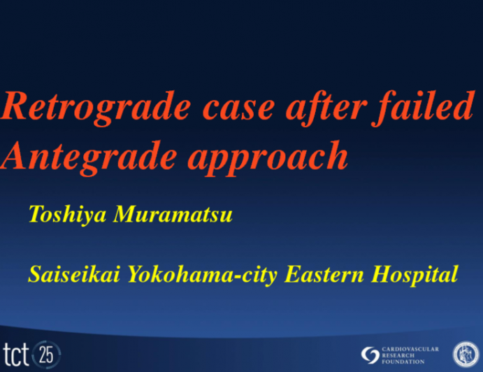 Case #3: An Antegrade Failure that Changed my Practice