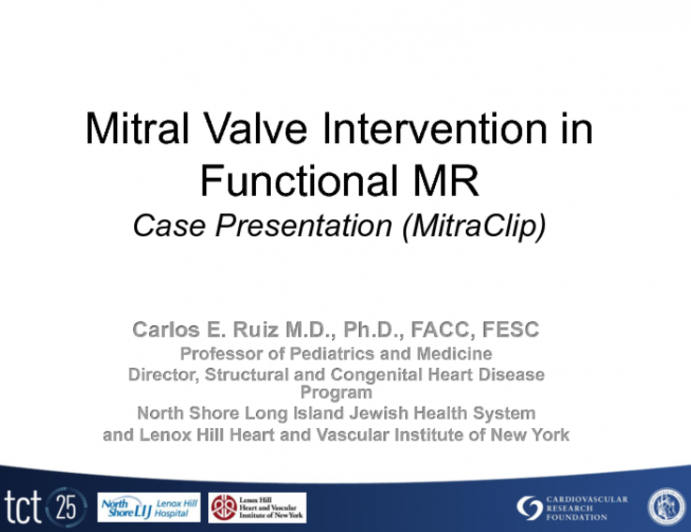 Case Presentation: Mitral Valve Intervention in Functional MR