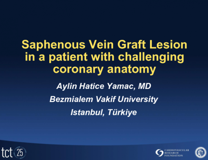 Case #2: A Saphenous Vein Graft Lesion in a Patient with Challenging Coronary Anatomy