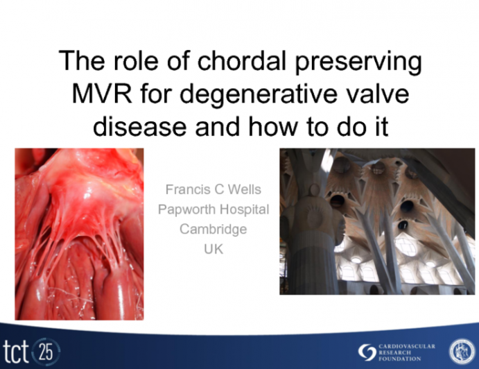 The Role of Chordal Preserving MVR for Degenerative Disease and How to Do It!