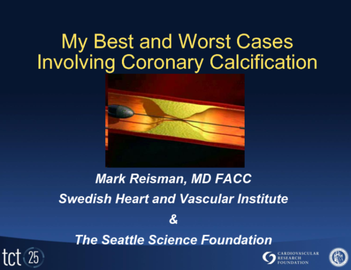 My Best and Worst Cases Involving Coronary Calcification