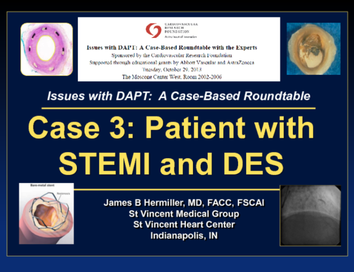 Case 3: Patient with STEMI and DES