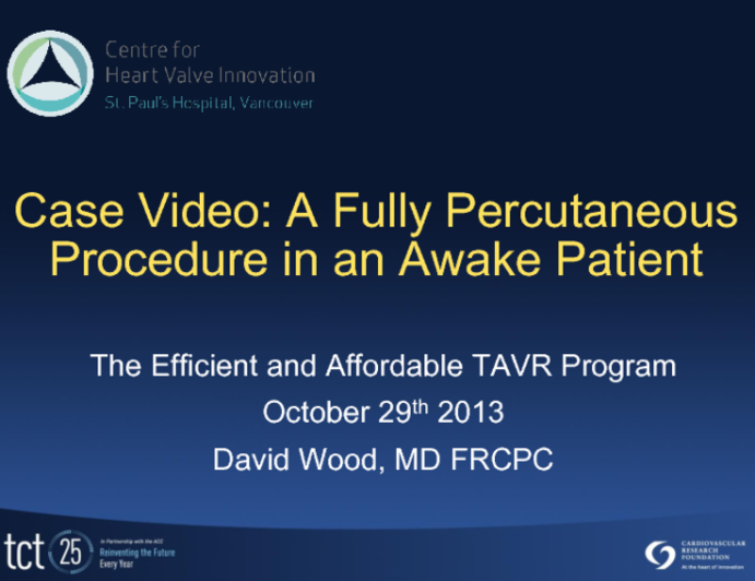 Case Video: Fully Percutaneous Procedure in an Awake Patient
