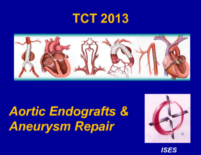 Endovascular Solutions for AAA Disease Extending into the Common Iliac Artery