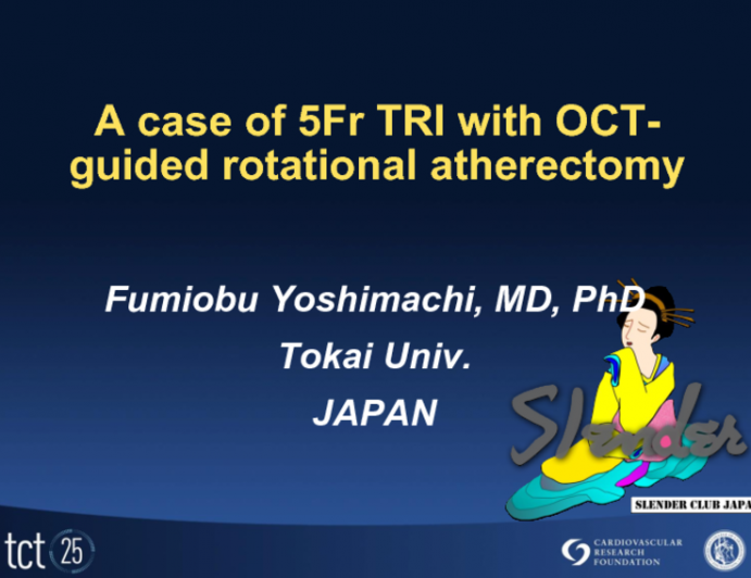 A Case of 5 Fr Transradial Intervention with OCT-Guided Rotational Atherectomy