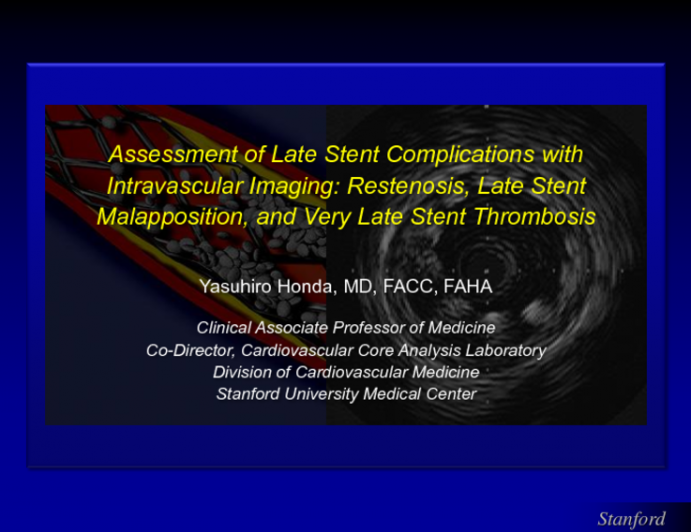 Assessment of Late Stent Complications with Intravascular Imaging: Restenosis, Late Stent Malapposition, and Very Late Stent Thrombosis