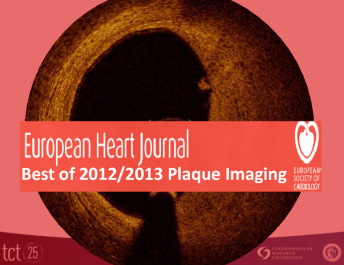 Imaging Coronary Plaques: Best of EHJ